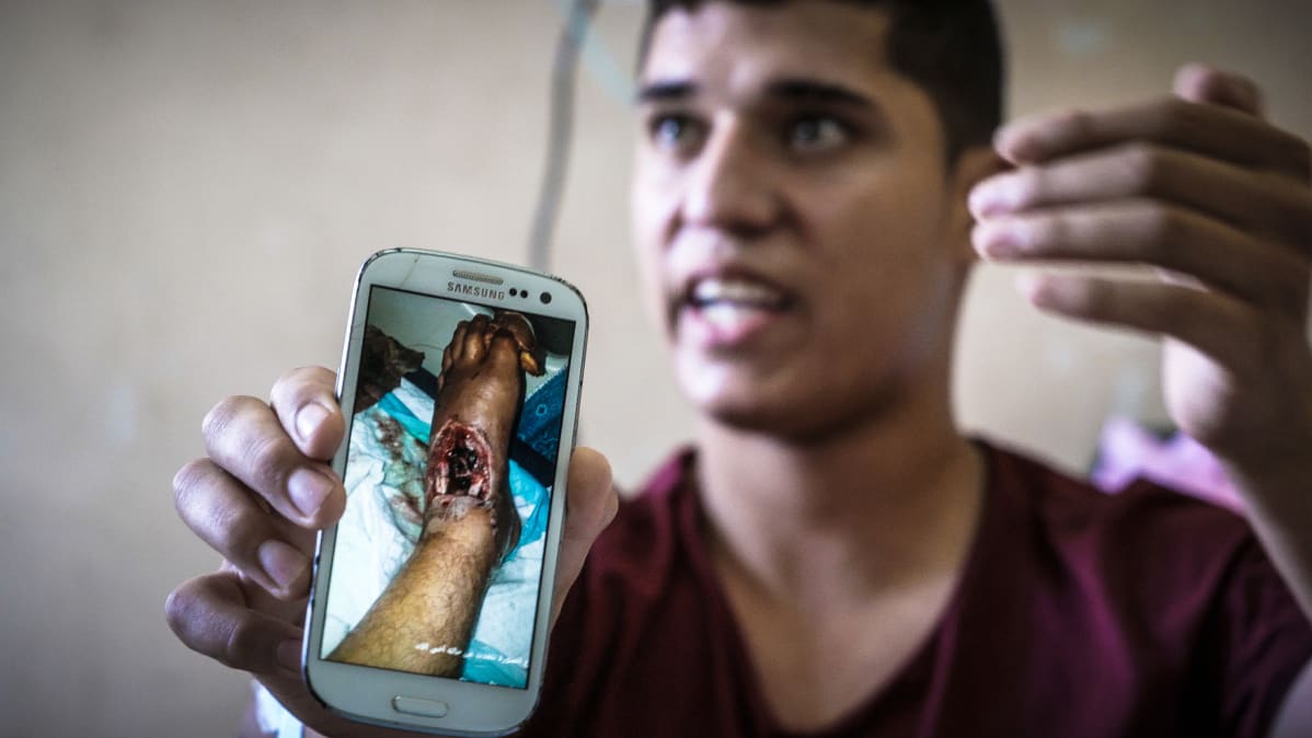 Israelin armeijan luoti tuhosi Ahmadin nilkan ja unelman jalkapallourasta. Hän on kuukausien ajan odottanut lupaa siirtyä Gazan ulkopuolelle hoitoon, jotta jalka voitaisiin pelastaa amputaatiolta.