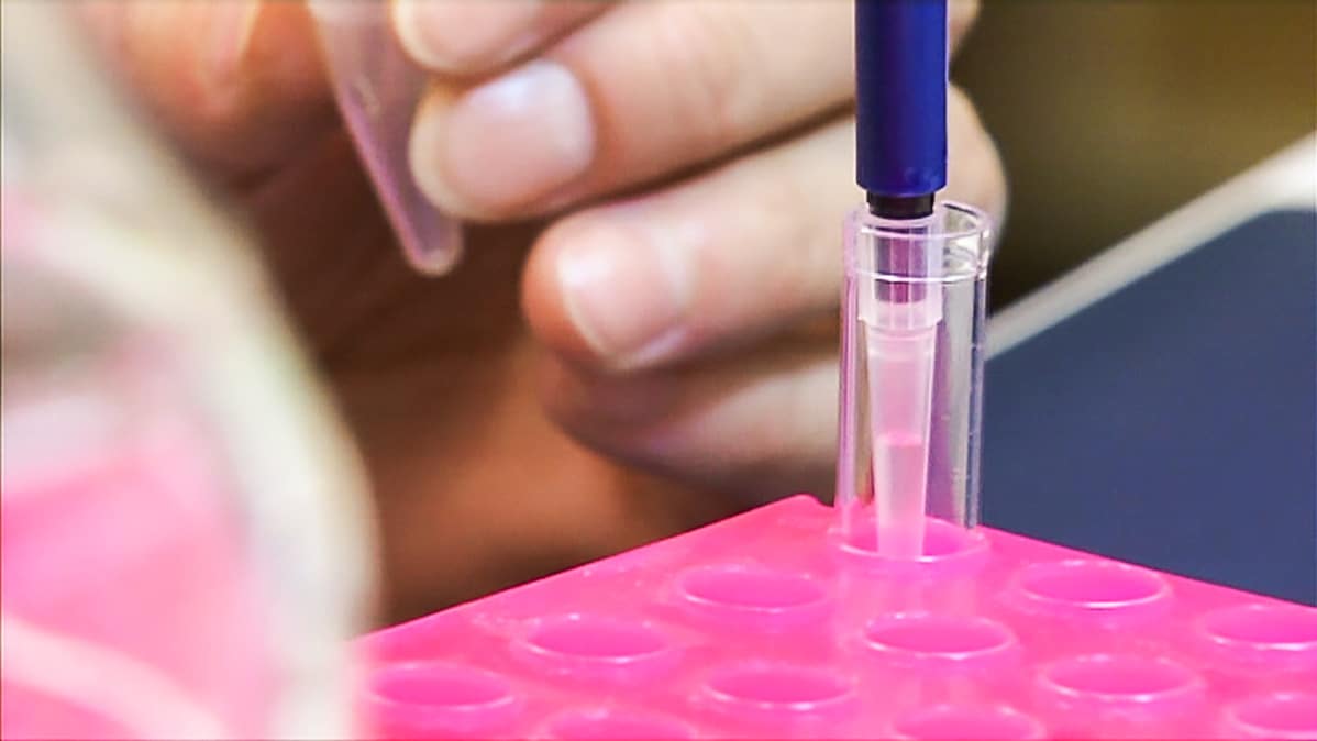 syöpähoito immunoterapia koeputki laboratorio