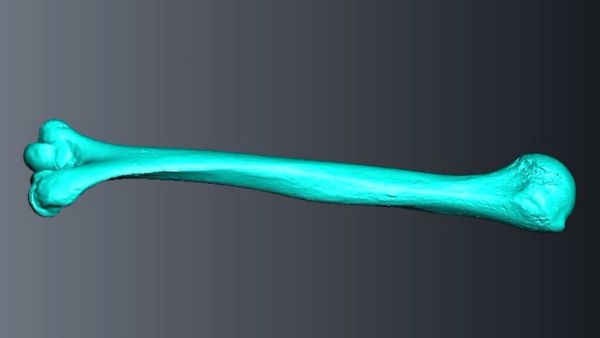 3D-kuva olkaluusta.