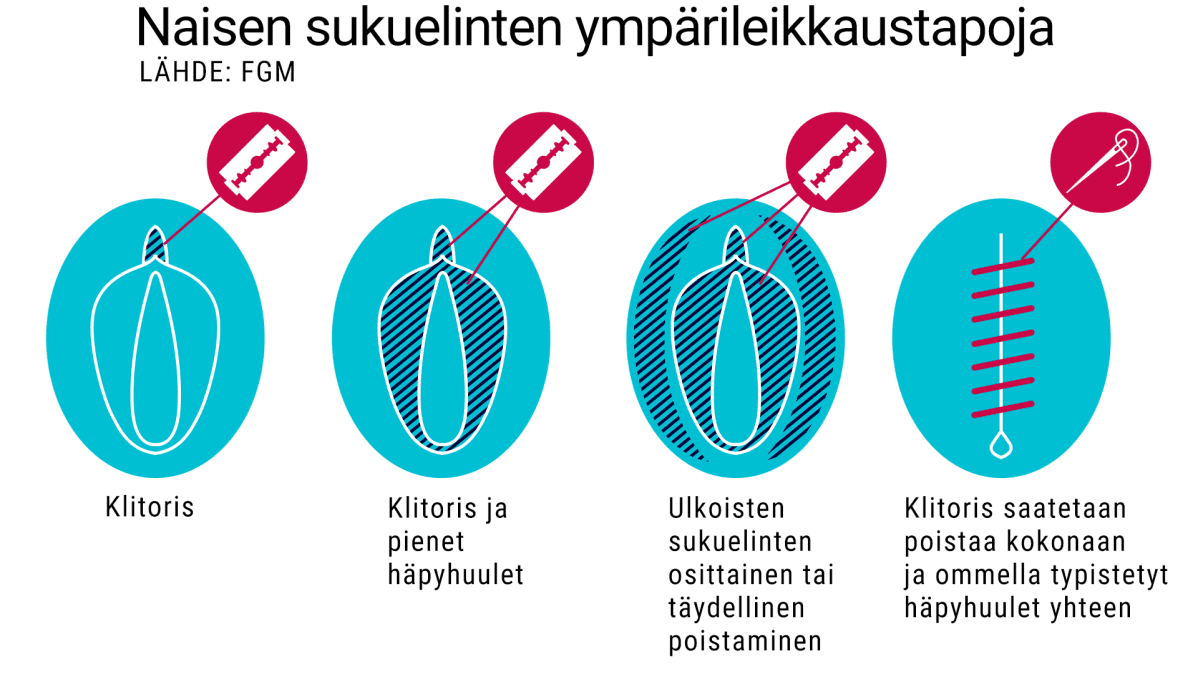 naisen sukuelimen ympärileikkaustapoja, grafiikka