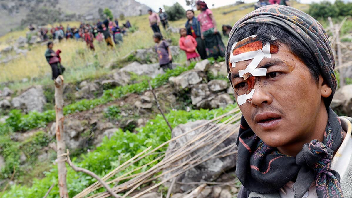 Nepalin maanjäristyksessä loukkaantunut nuori mies odottaa apua Uiyan kylässä.