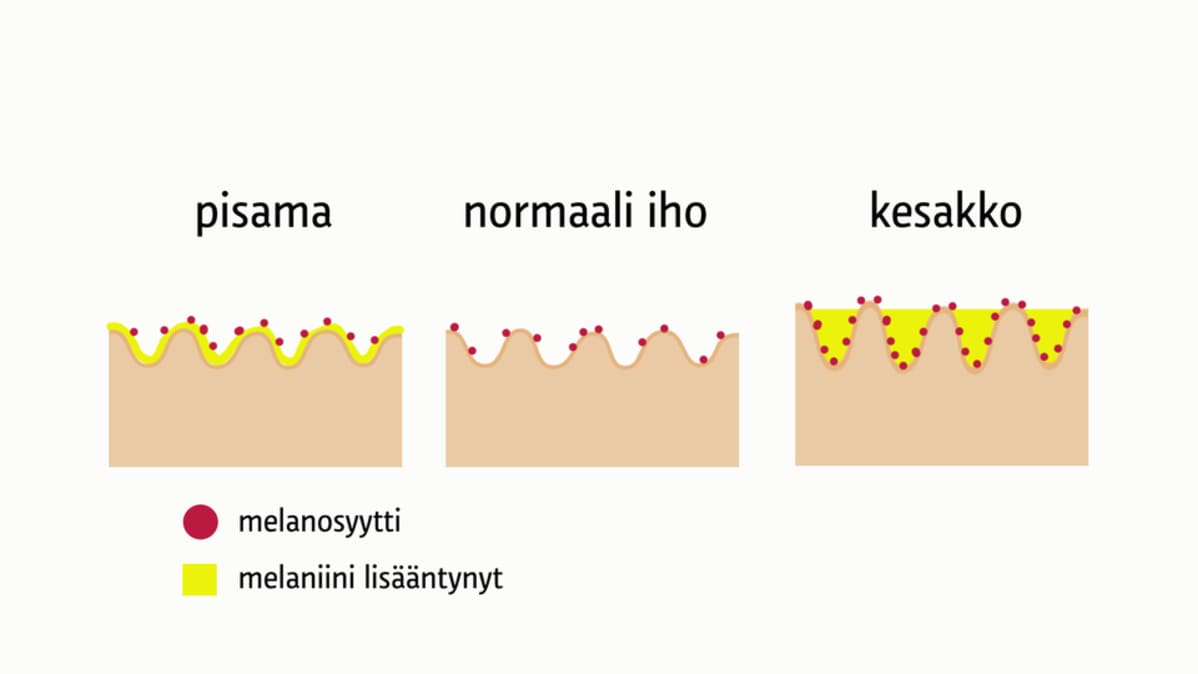 Pisama ja kesakko.