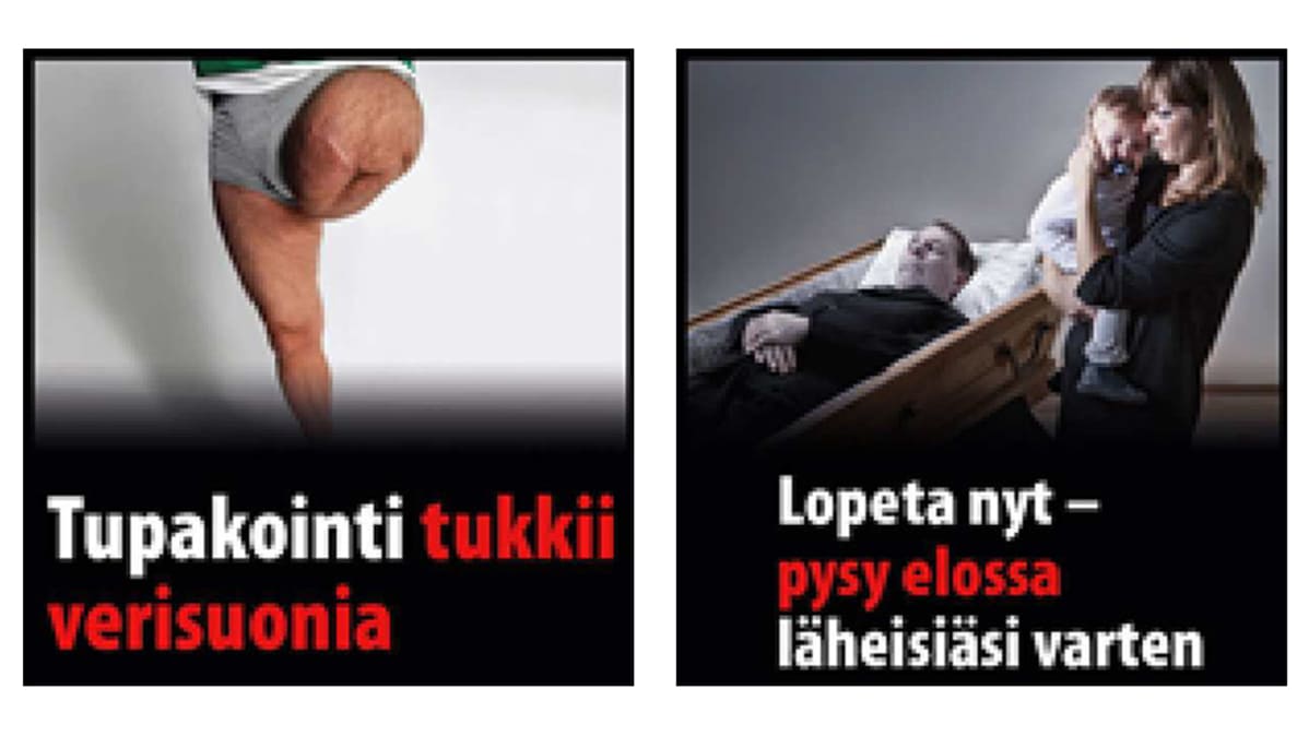 Kaksi tupakka-askiin tulevaa varoituskuvaa. Toisessa näkyy henkilö, jolta on amputoitu toinen jalka. Toisessa taas äiti ja lapsi seisovat ruumisarkussa makaavan miehen vierellä.
