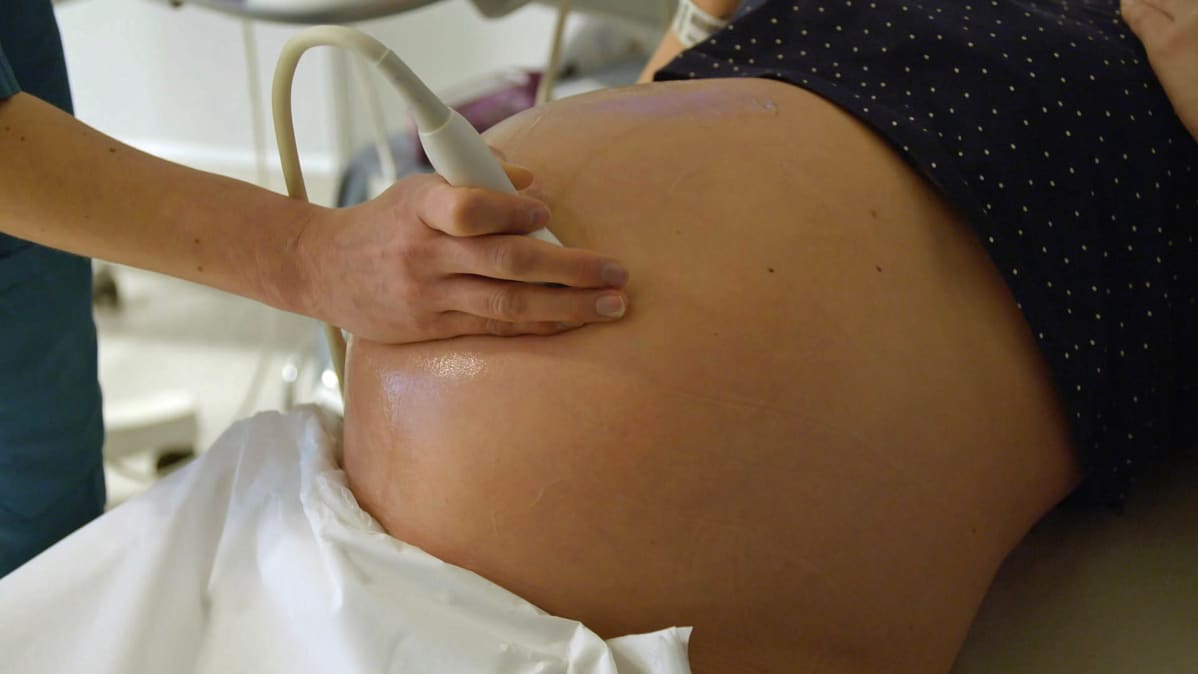 Odottava äiti ultraäänitutkimuksessa