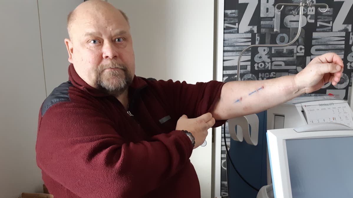Mies näyttää vasenta käsivarttaan.