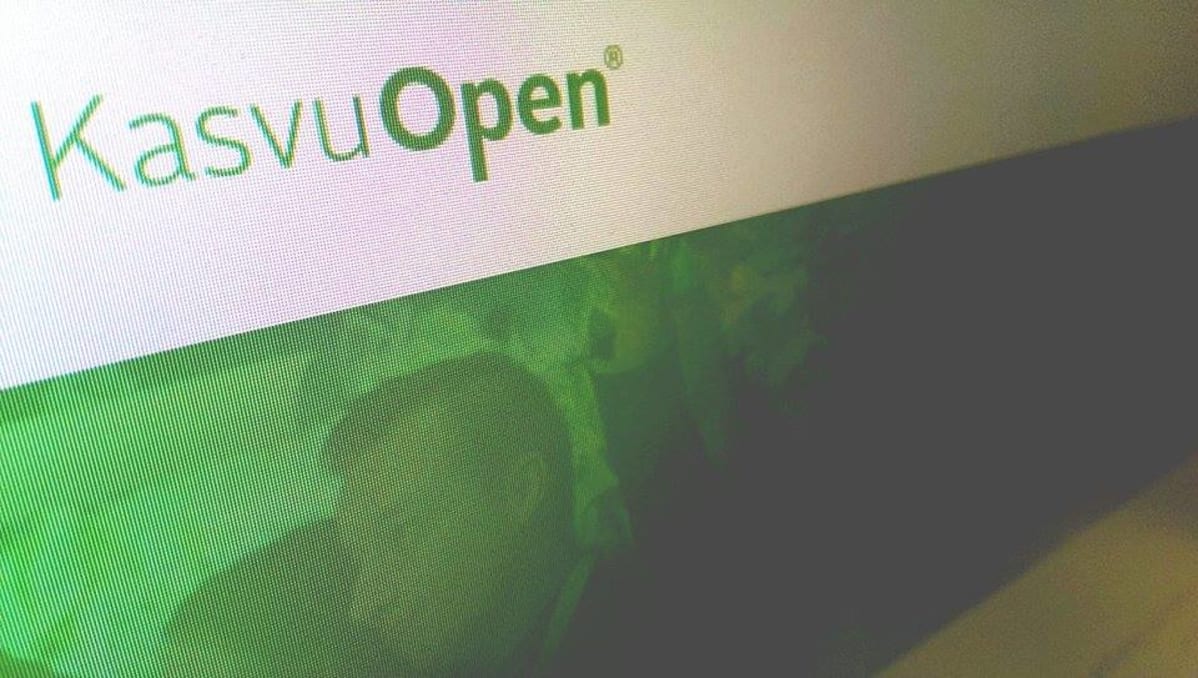 Kasvu Open -nettisivu ruudulta kuvattuna.