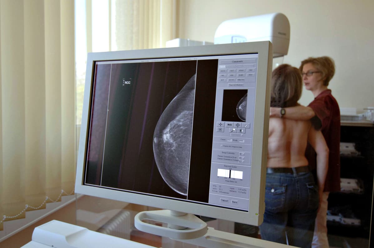Mammografiakuvaus.