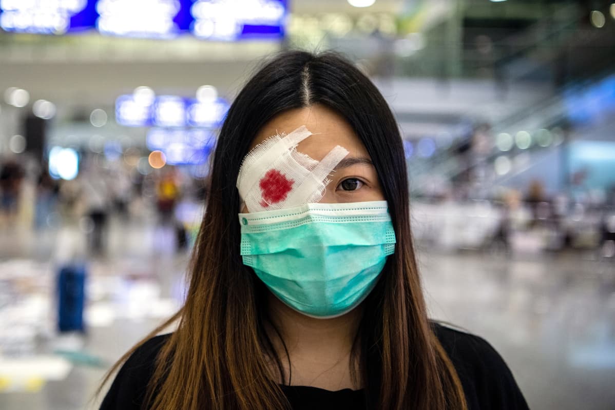 Lentokentällä saapunut protestoija pitää itse tekemäänsä silmälappua. Sillä viitataan naiseen, jota poliisin väitetään ampuneen silmään Hongkongin levottomuuksissa.