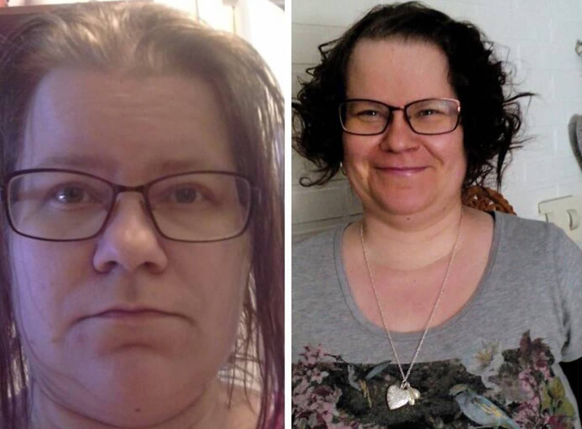 Sanna Pohjaniemi ennen ja jälkeen poisto-operaation
