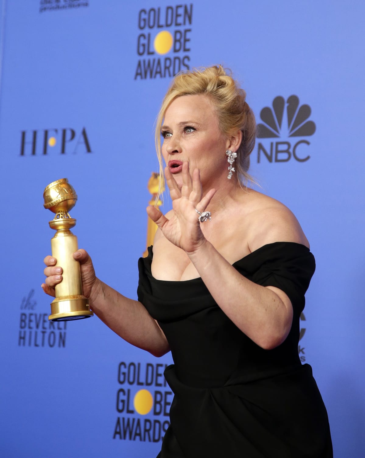 Patricia Arquette on voittanut Golden Globe –palkinnon parhaana näyttelijänä tv-sarjassa.