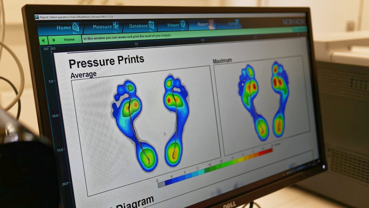 Biomekaaninen lähestymistapa huomioi ihmisen biologisen ja anatomisen variaation.