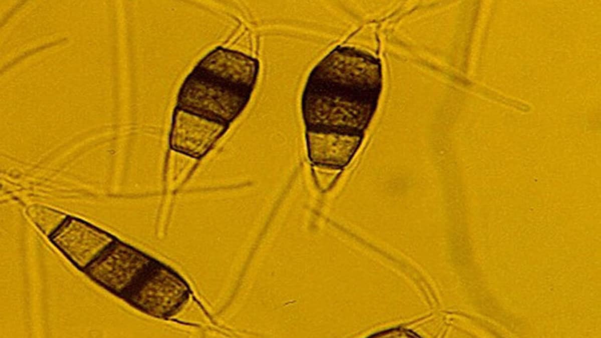 Kasvin sisällä elävät mikrosienet ovat yksi kasvibiologian suosituimpia tutkimuskohteita. Esimerkiksi lääketeollisuus on kiinnostunut niiden erittämien yhdisteiden mahdollisuuksista.