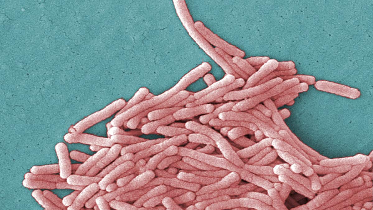 Elektronimikroskooppilla otettu 8000-kertainen suurennus Legionella Pneumophila -bakteerista.