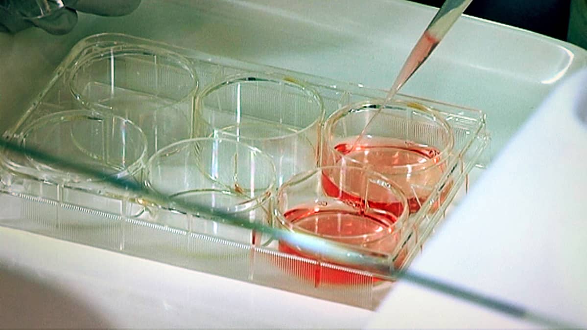 Soluja ruokitaan ravintoliuoksella laboratoriossa