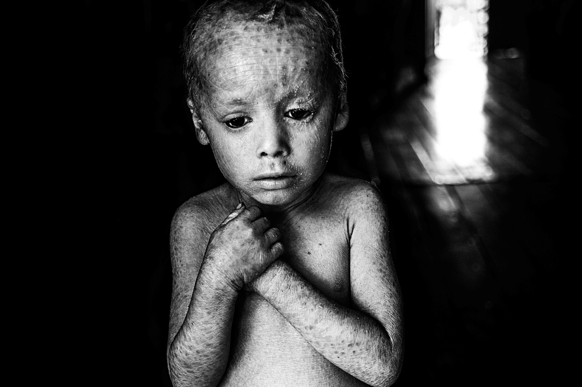 Pablo Ernesto Piovano, The Human Cost of Agrotoxins, 2015