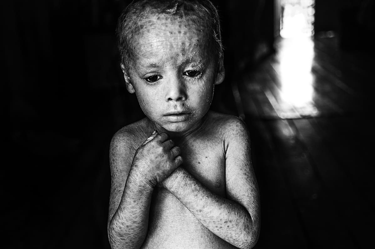 Pablo Ernesto Piovano, The Human Cost of Agrotoxins, 2015