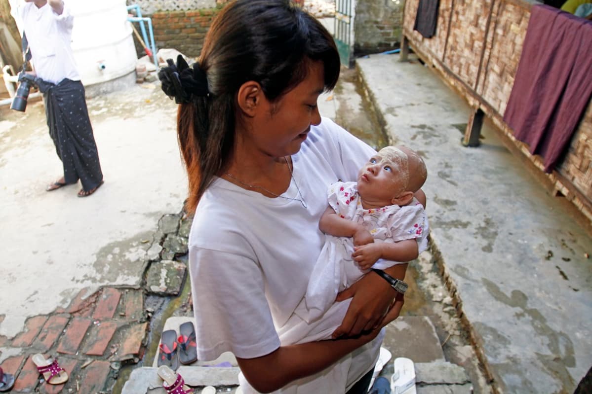 Myanmarilainen vapaaehtoistyöntekijä