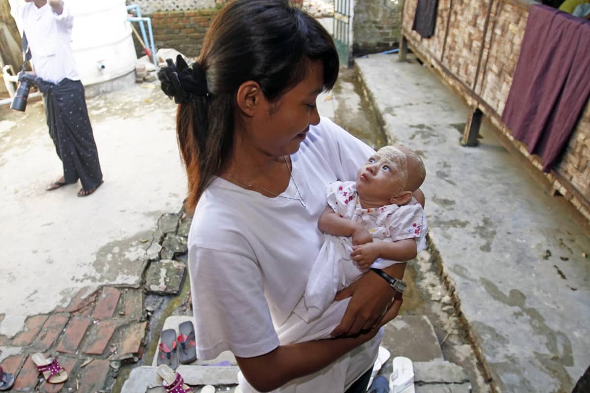 Myanmarilainen vapaaehtoistyöntekijä