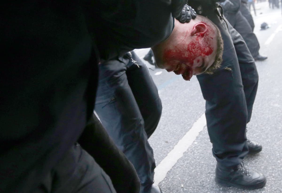 Verta vuotava mielenosoittaja Saksan poliisin kiinniottamana Hampurissa torstaina 6. heinäkuuta.