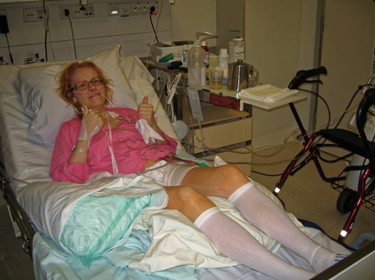 Helena Kummala Meilahden teho-osastolla kolme päivää keuhkonsiiron jälkeen.