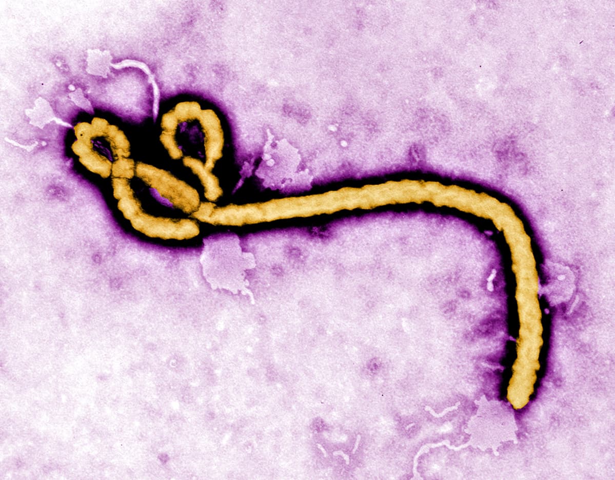Mikroskooppikuva Ebola viruksesta