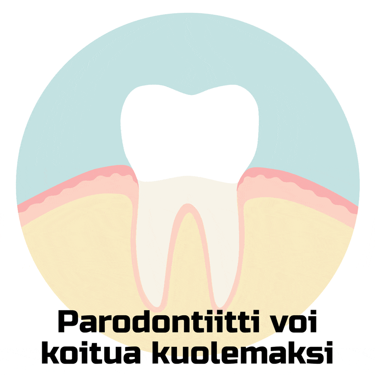 Parodontiitti voi koitua kuolemaksi -piirros