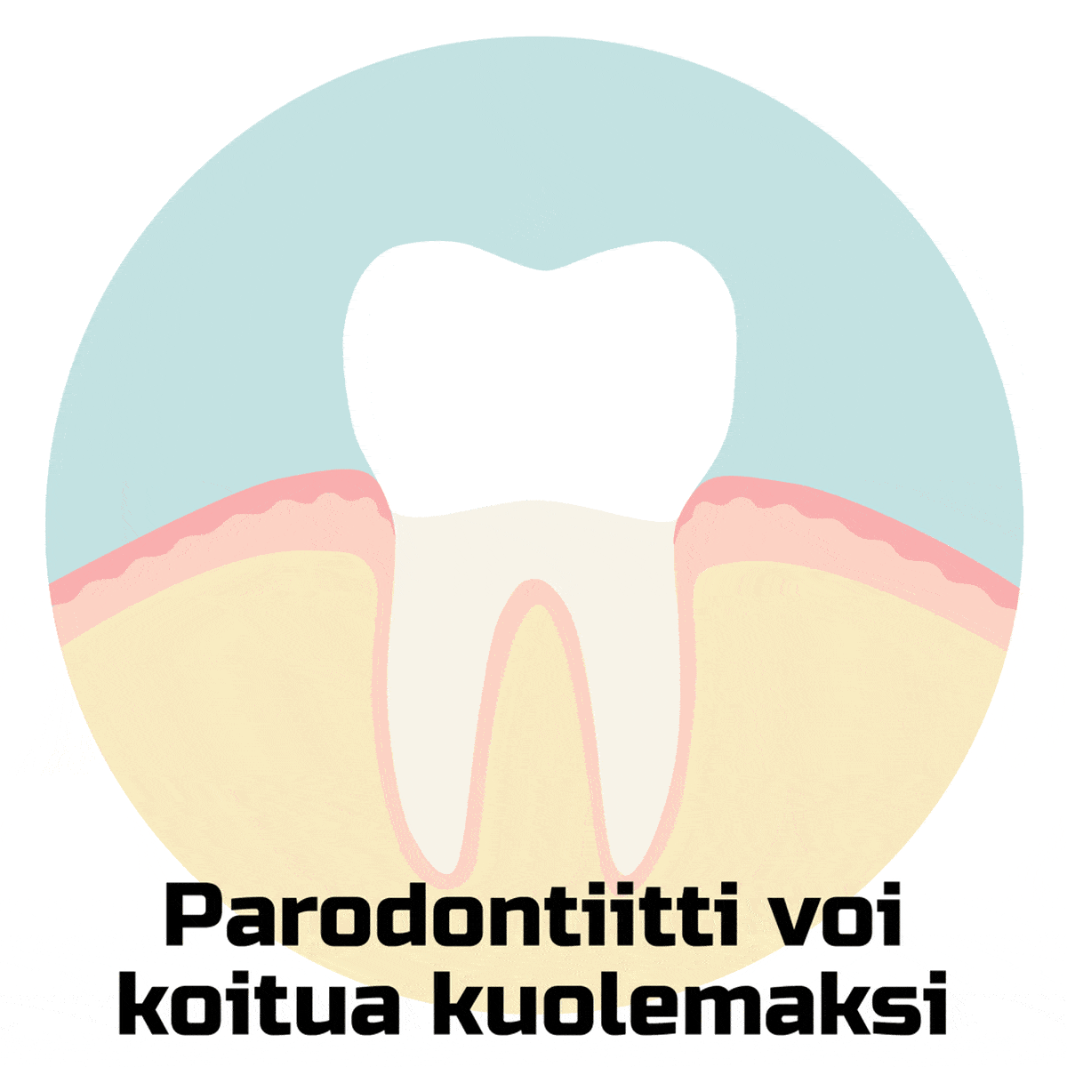Parodontiitti voi koitua kuolemaksi -piirros