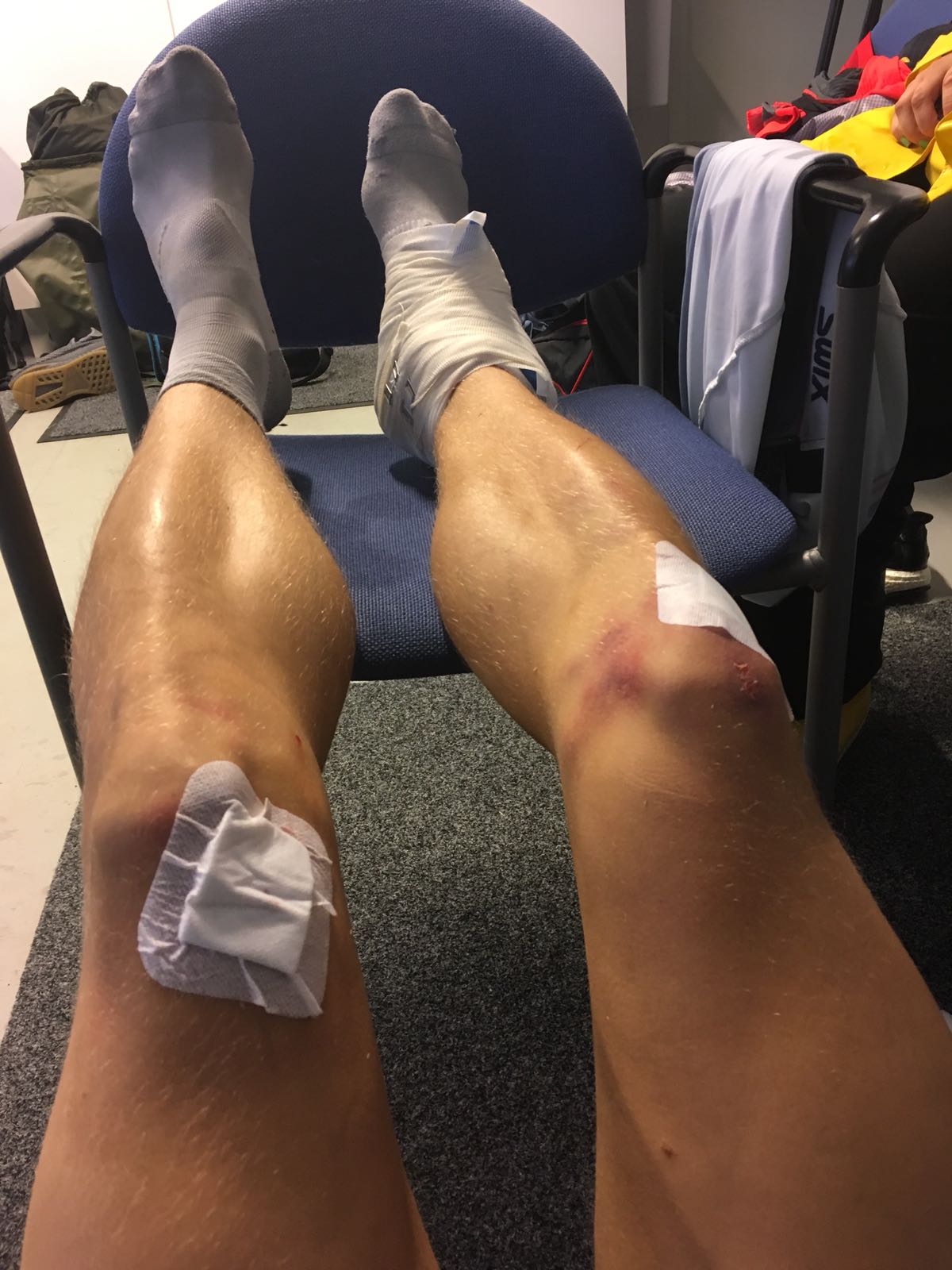 Anssi Pentsisen jalat