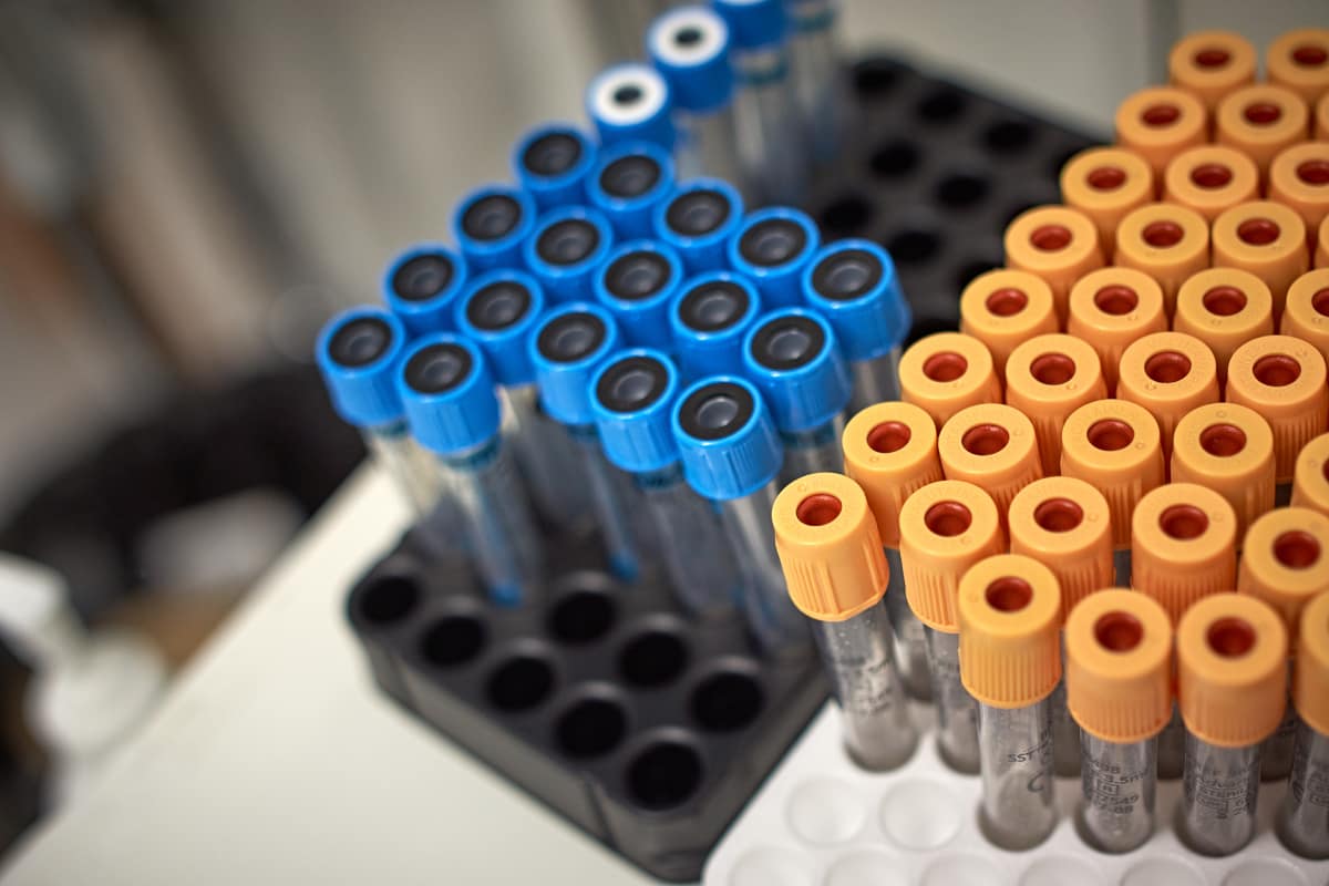 laboratorion näyteputkia