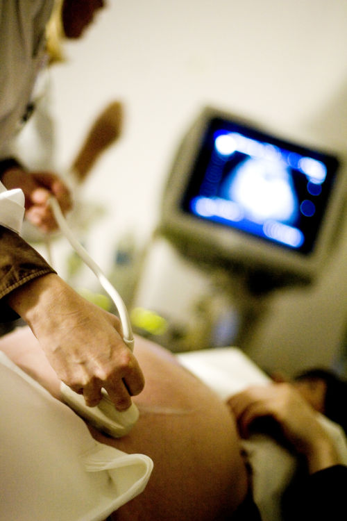 raskaana oleva ultraäänitutkimuksessa