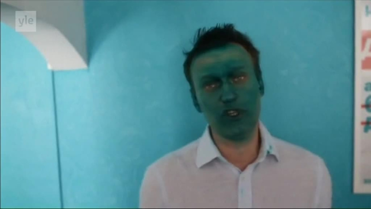 Uutisvideot: Venäjällä heitettiin vihreää nestettä oppositiojohtaja Navalnyin naamalle