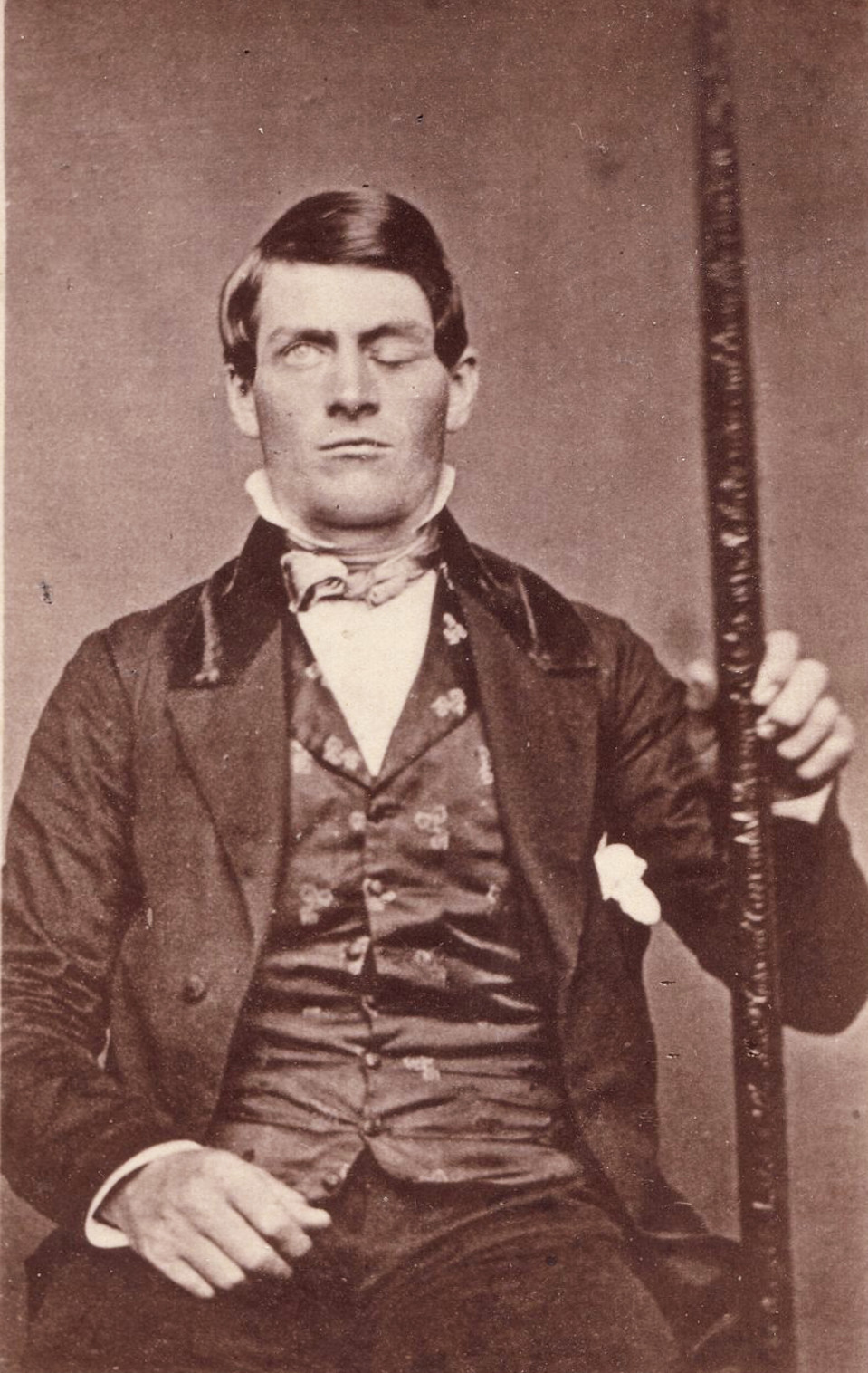 Phineas Gage