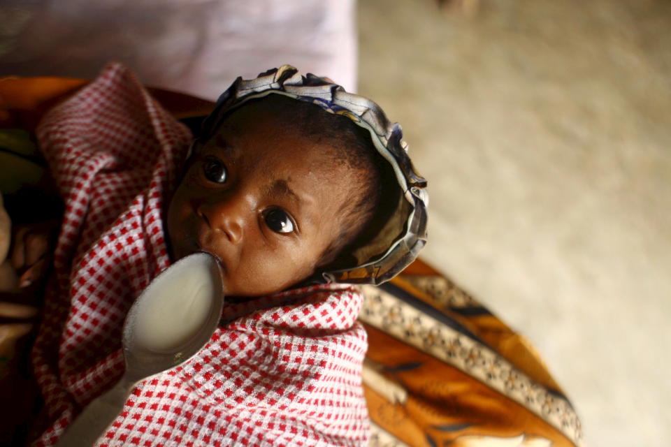 Aliravittu lapsi saksalaisen Agro Actionin apukeskuksessa Nosy Varikan kylässä Itä-Madagaskarissa 18.7.2007.