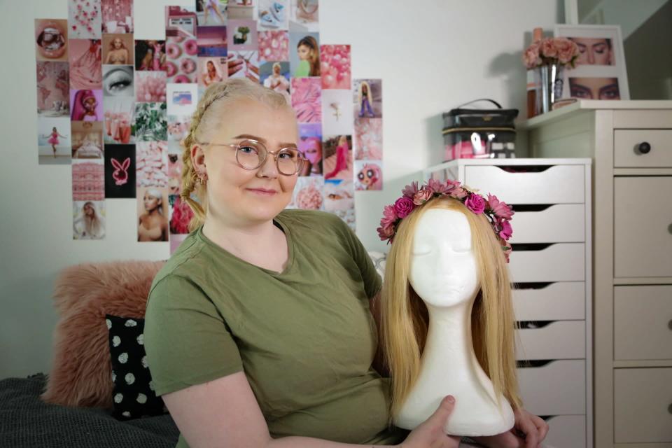 Vilma Parkkonen käytti peruukkia, kun syöpä vei hiukset.