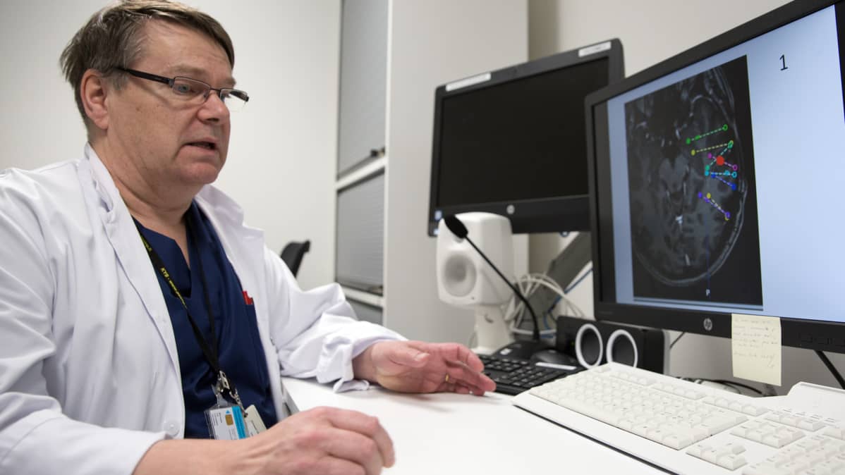 Mies näyttöpäätteen ääressä KYS:in epilepsiakeskuksessa.