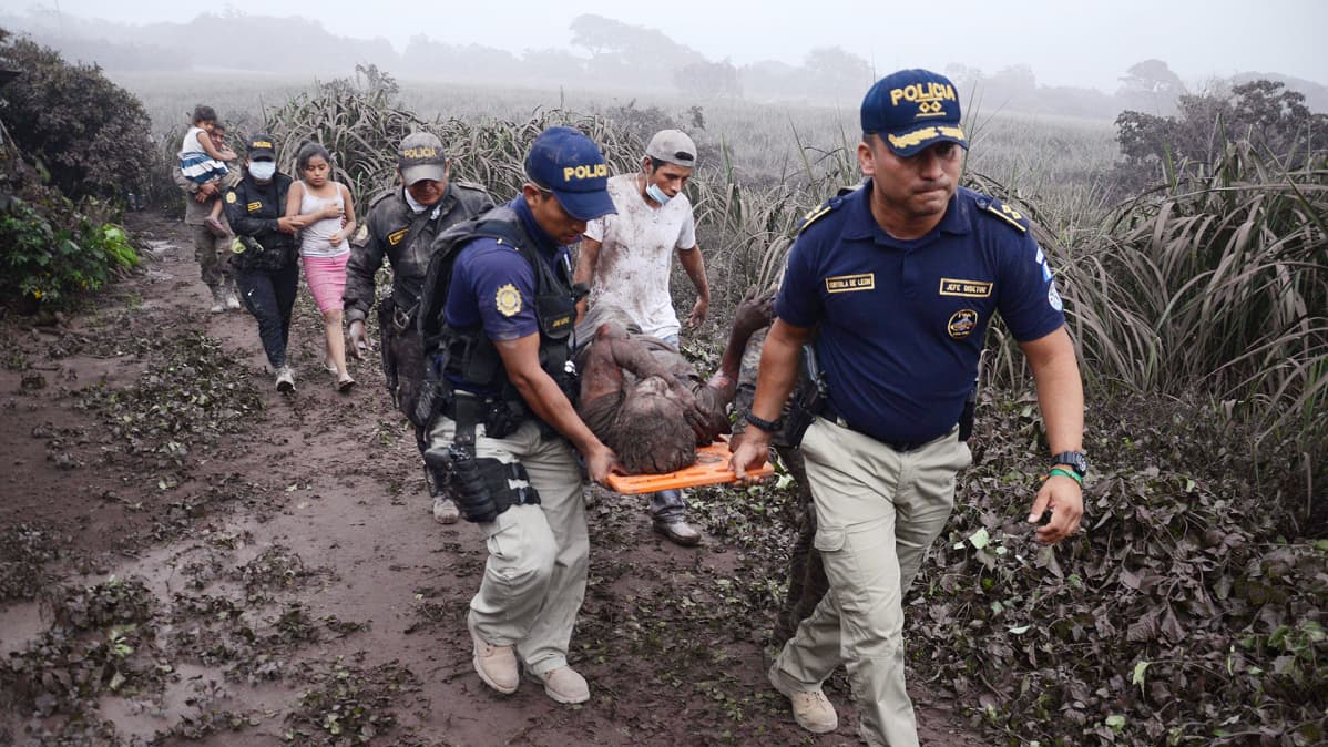 Poliisit kantoivat tulivuoren purkauksen takia loukkaantunutta miestä El Rodeon kylässä Guatemalassa sunnuntaina.