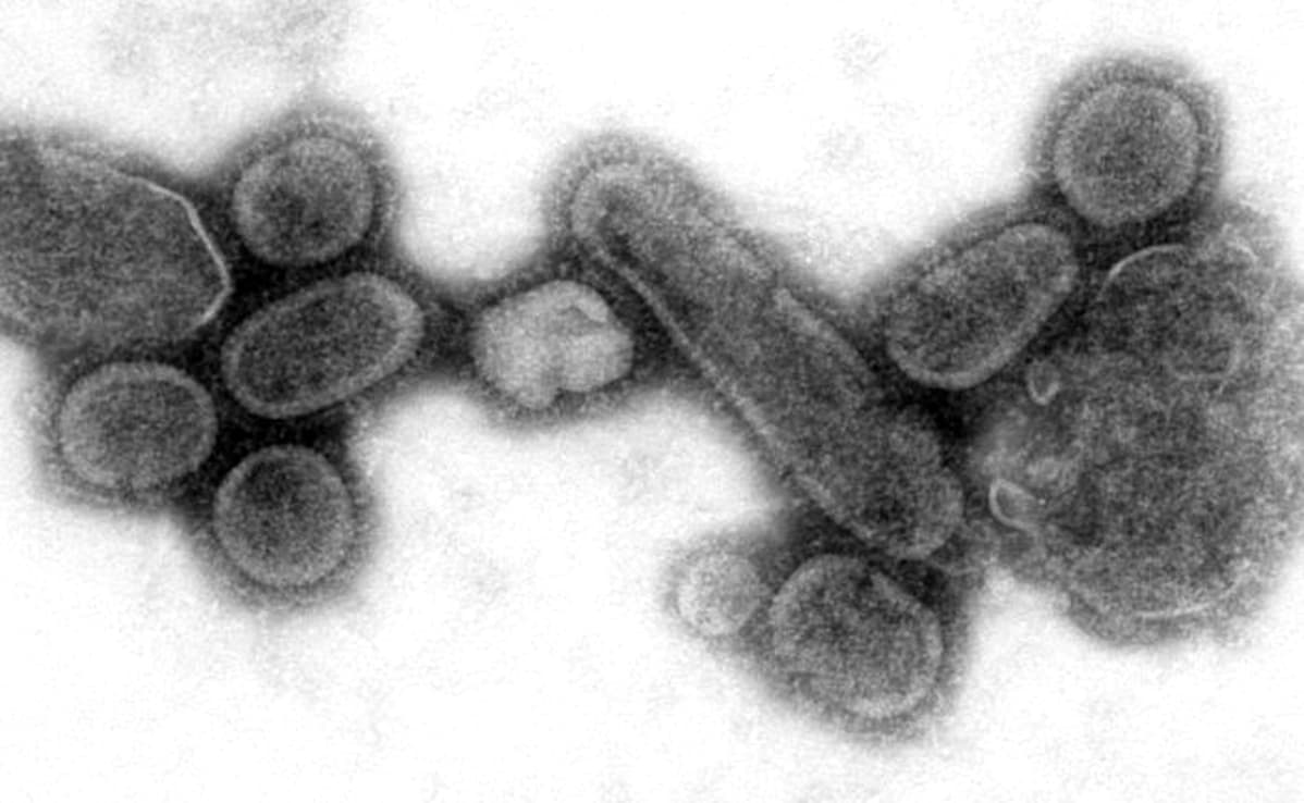Virus