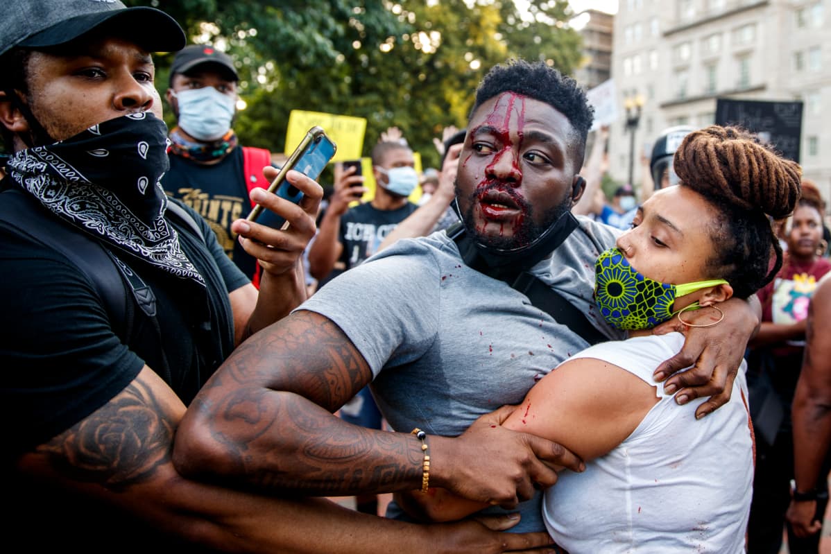 BLM