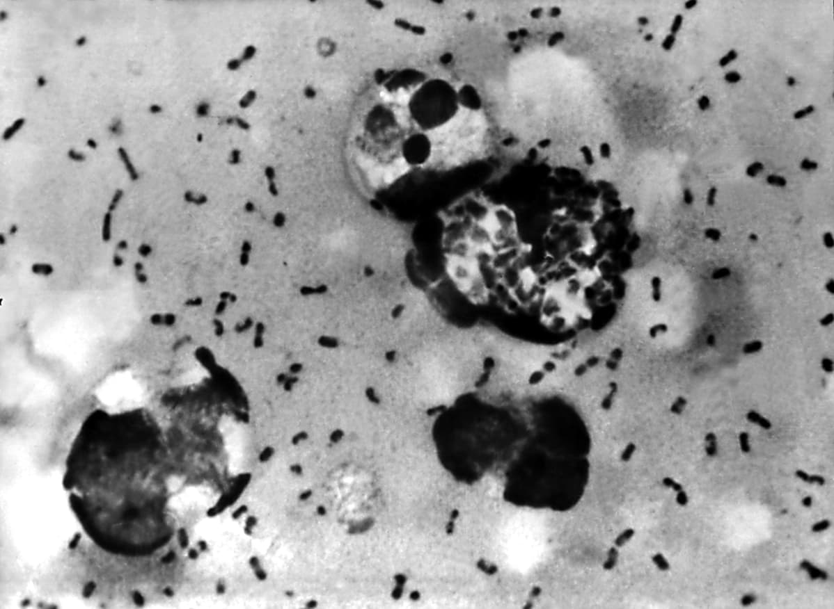 Yersina pestis -bakteeri