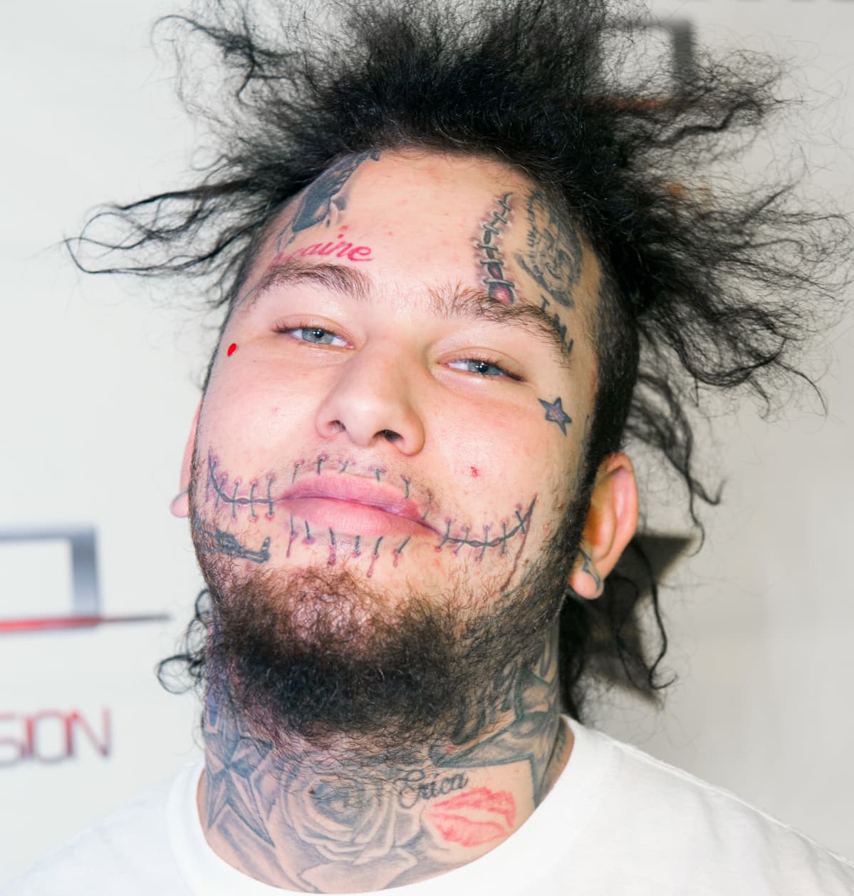 Stitches