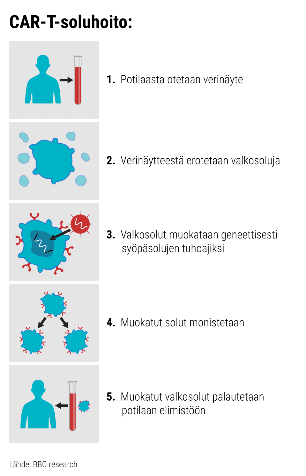 Kuvasarja joka kuvaa CAR-T-soluhoidon kulun. 1. Potilaasta otetaan verinäyte. 2. Verinäytteestä erotetaan valkosoluja. 3. Valkosolut muokataan geneettisesti syöpäsolujen tuhoajiksi. 4. Muokatut solut monistetaan. 5. Muokatut valkosolut palautetaan potilaan elimistöön. Kuvasarjan lähde BBC research.