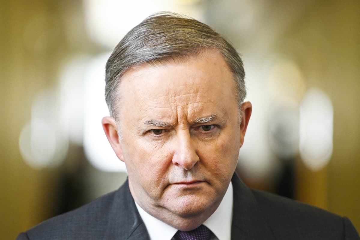 Anthony Albanese