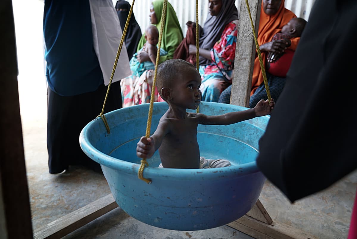 Somalia kuivuus nälkä nälänhätä