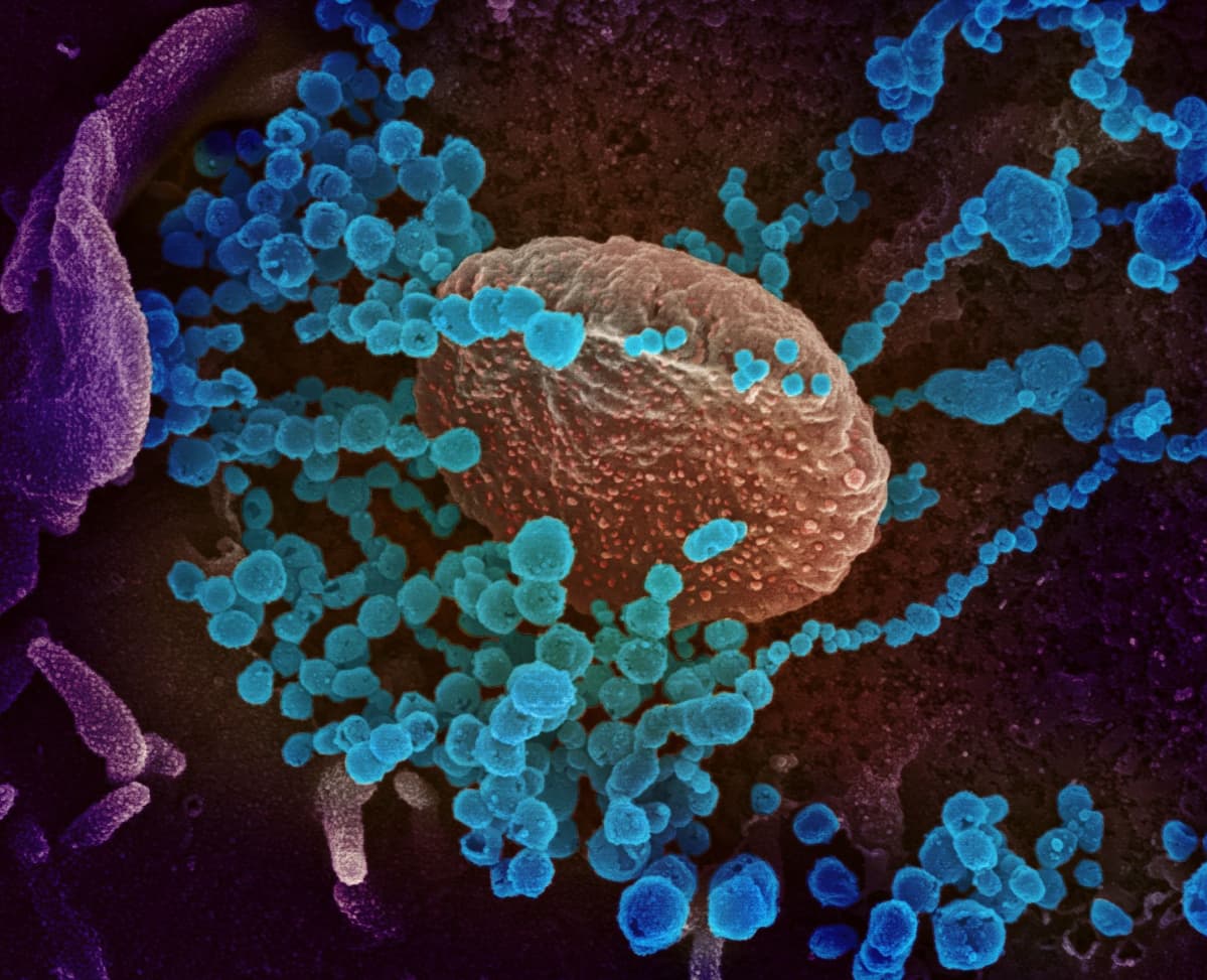 Koronavirus elektronimikroskooppikuvassa.