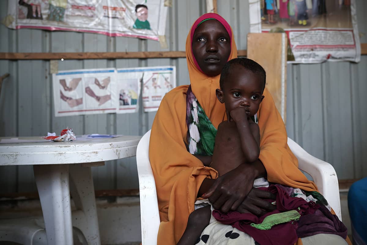 Somalia kuivuus nälkä nälänhätä