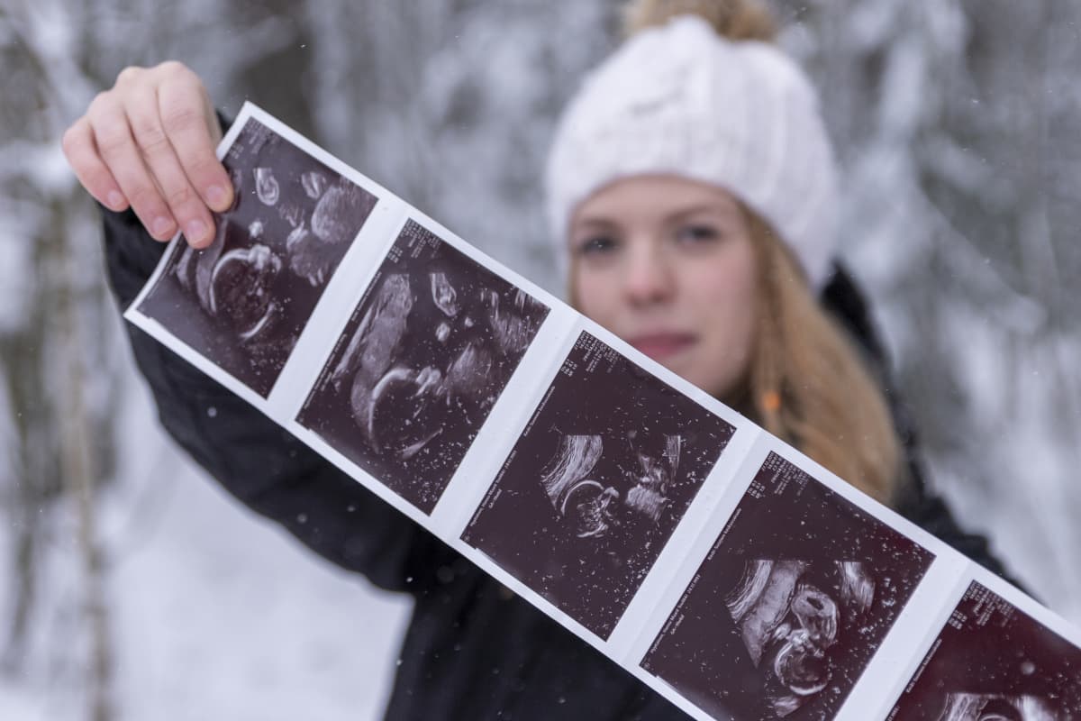 Hanna Hyytiäinen näyttää ultraäänikuvaa sikiöstään.