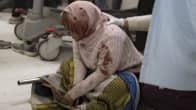 Haavoittunut nainen Gazassa
