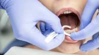 Hammaslääkäri puhdistaa potilaan hammasväliä.