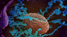 Koronavirus elektronimikroskooppikuvassa.