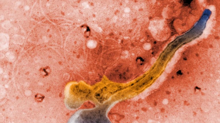  Mikroskooppikuva Treponema pallidum -bakteerista.